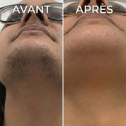 Serum végétale ralentisseur de pousse