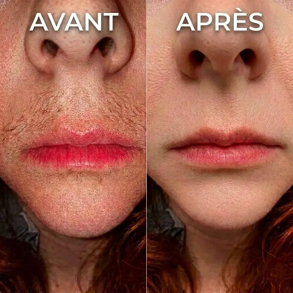 Serum végétale ralentisseur de pousse